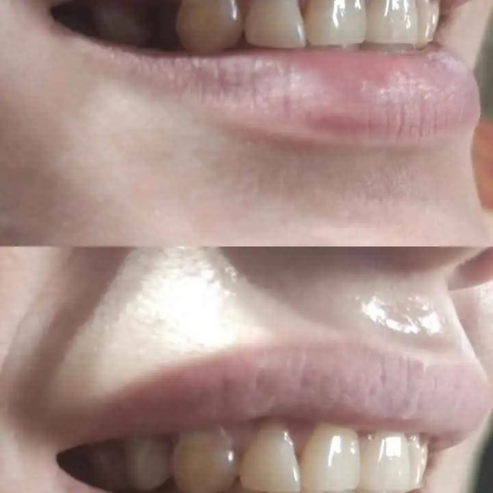 Sonrisas
