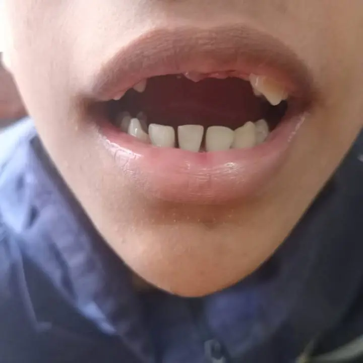 Servicio de prótesis dentales