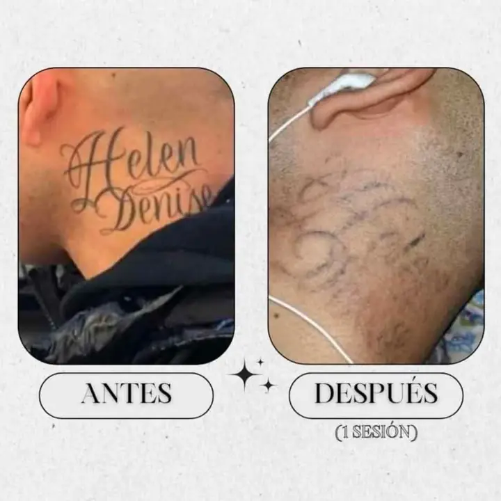 No mas tatuajes
