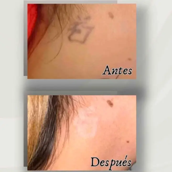 Chau tattoo