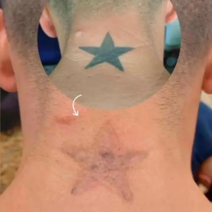 Chau tatuaje