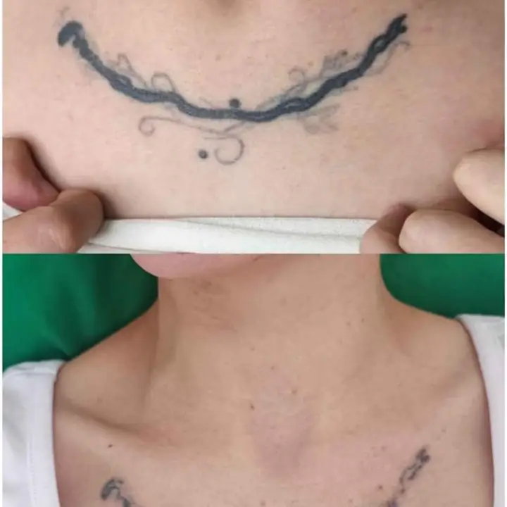 Tatuaje