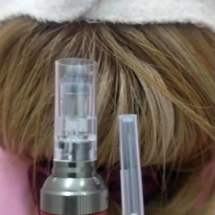 Tratamiento capilar alopecia caída unisex